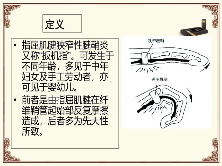 狭窄性腱鞘炎讲义课件.ppt_第2页