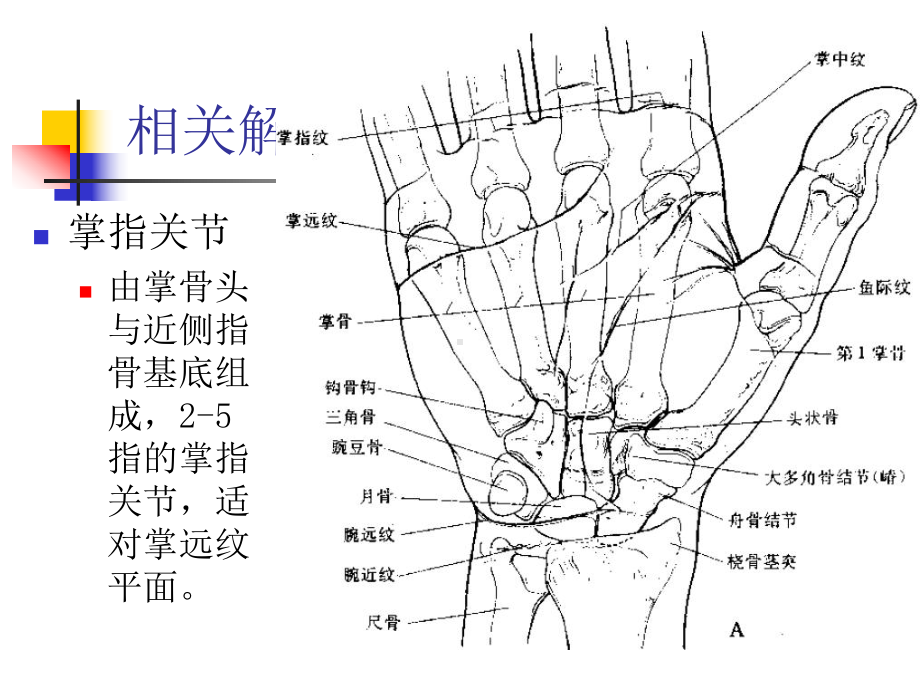 屈指肌狭窄性腱鞘炎优秀课件.pptx_第3页