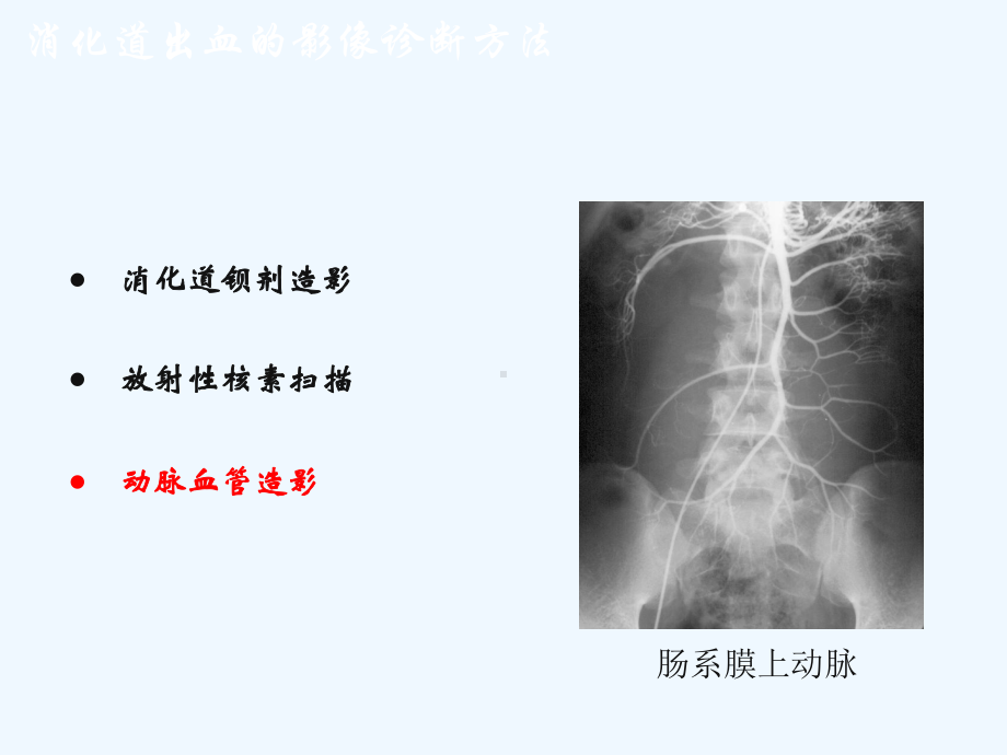 消化道出血的影象诊断和介入治疗邓小军课件.ppt_第3页