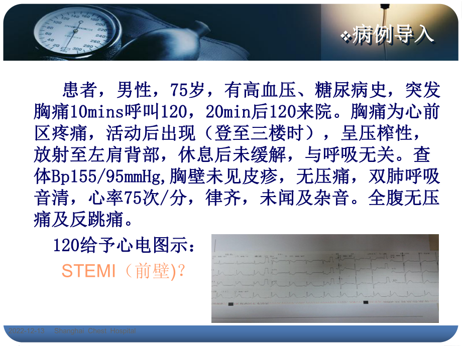 急诊胸痛中心-急救护理课件.ppt_第2页