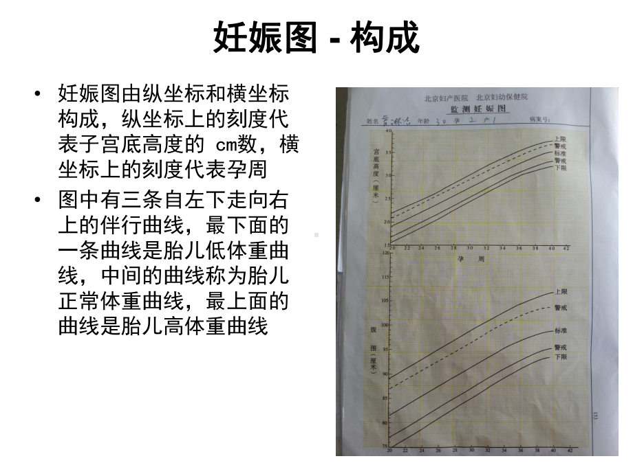 妊娠图绘制及识别课件.ppt_第3页