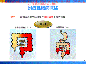 炎症性肠病IBD培训课件.ppt