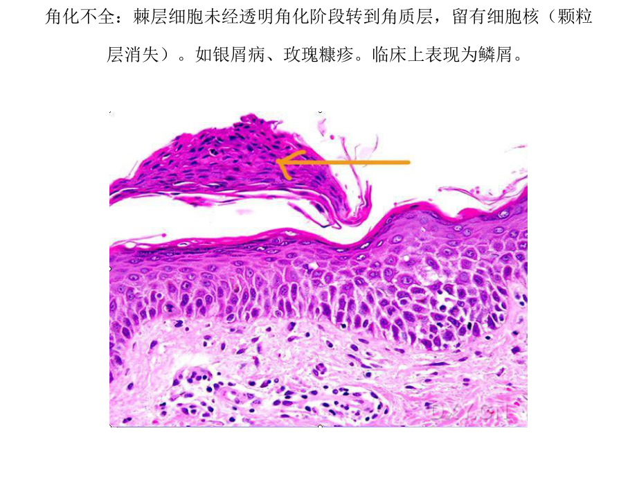 皮肤病理知识从入门到高级整理课件.ppt_第3页