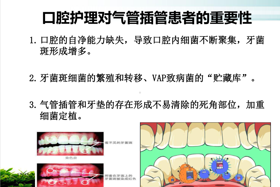 气管插管病人的口腔护理课件.pptx_第3页