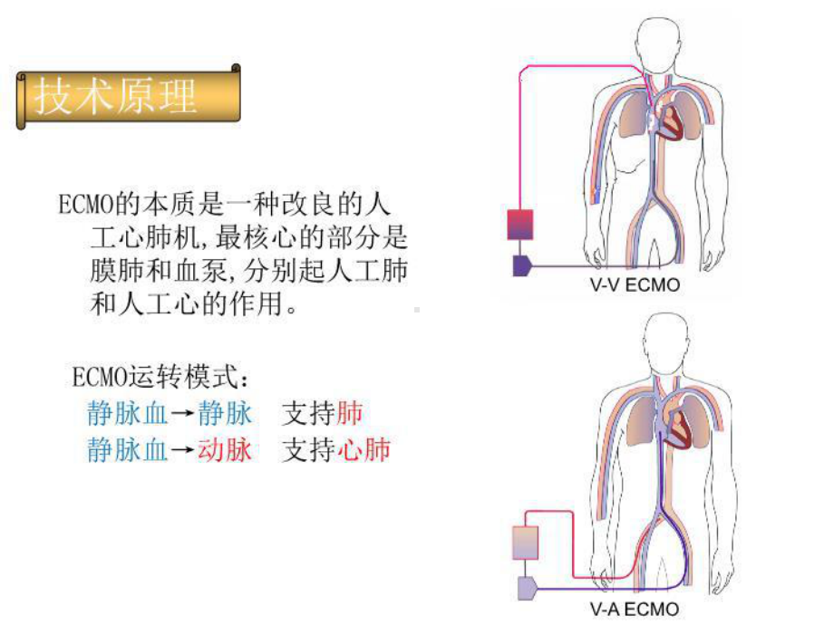 最新ECMO治疗危重患者进展课件.ppt_第3页