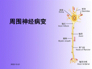 周围神经病变-sl课件.ppt