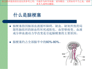 急性脑梗塞的溶栓治疗业务学习培训课件.ppt