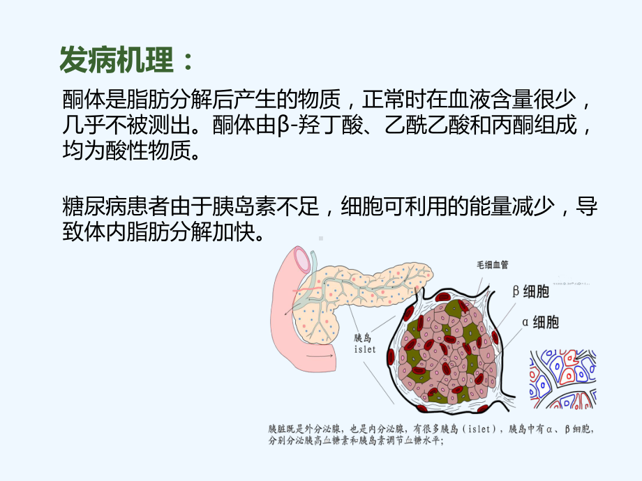 糖尿病酮症酸中毒病人护理查房课件讲义02.ppt_第3页