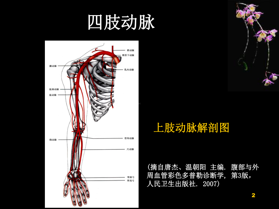 医学课件-外周血管超声表现教学课件.ppt_第2页