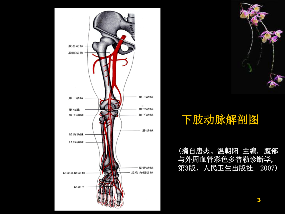 医学课件-外周血管超声表现教学课件.ppt_第3页