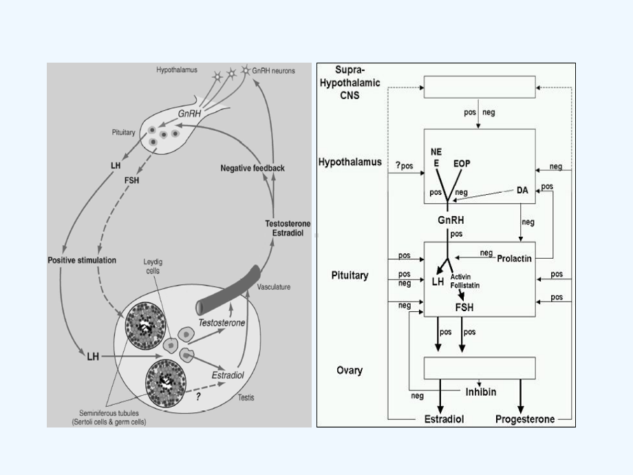 性腺功能减退分类病因诊断及治疗课件.ppt_第3页