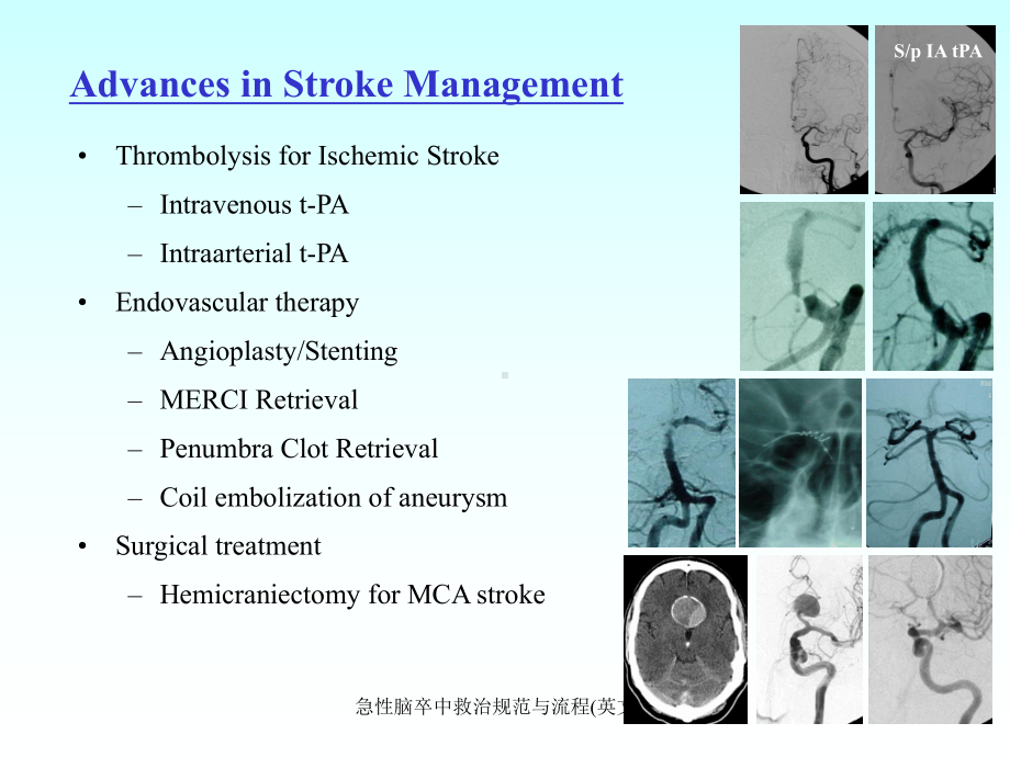急性脑卒中救治规范与流程(英文)课件.ppt_第3页