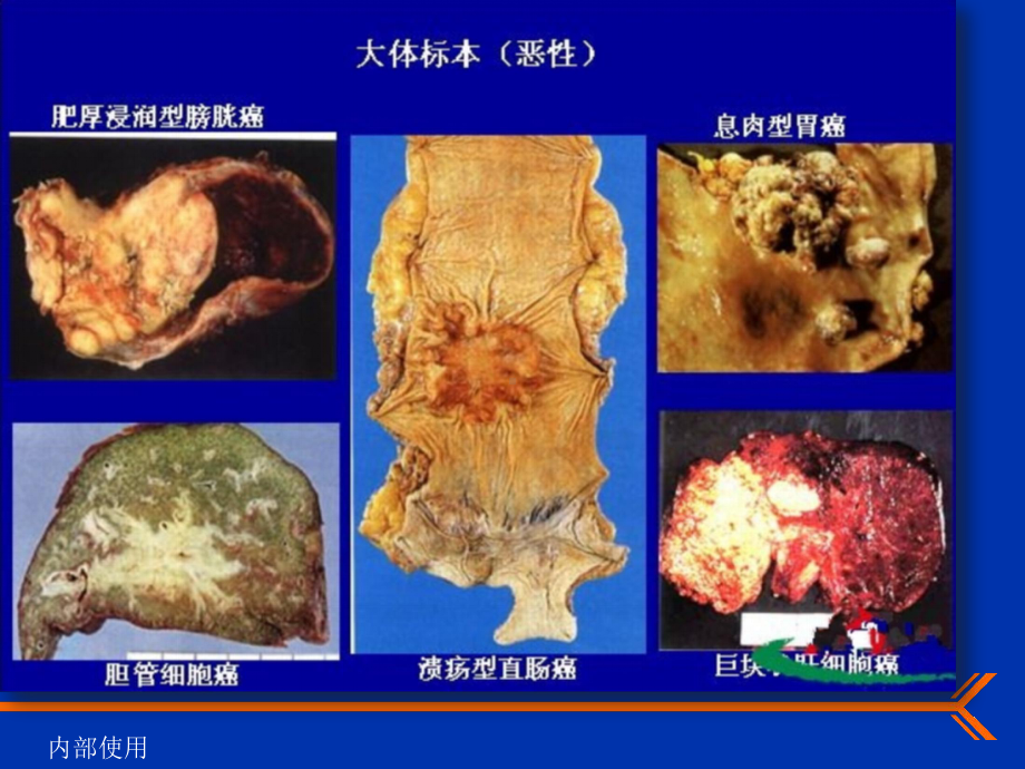 肿瘤学概论课件.pptx_第3页