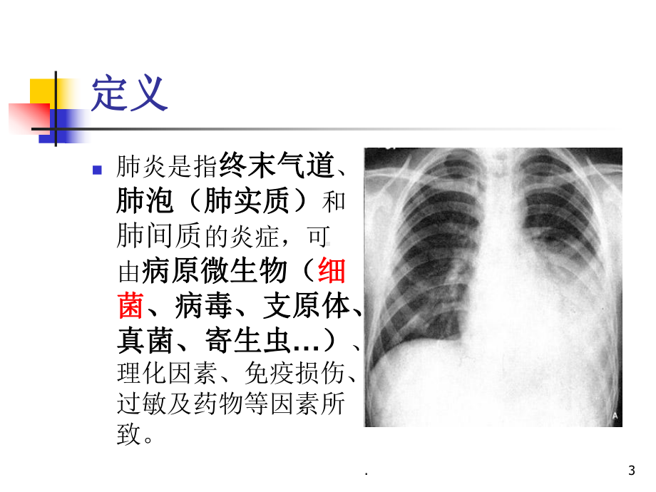 肺炎概述教学课件.ppt_第3页