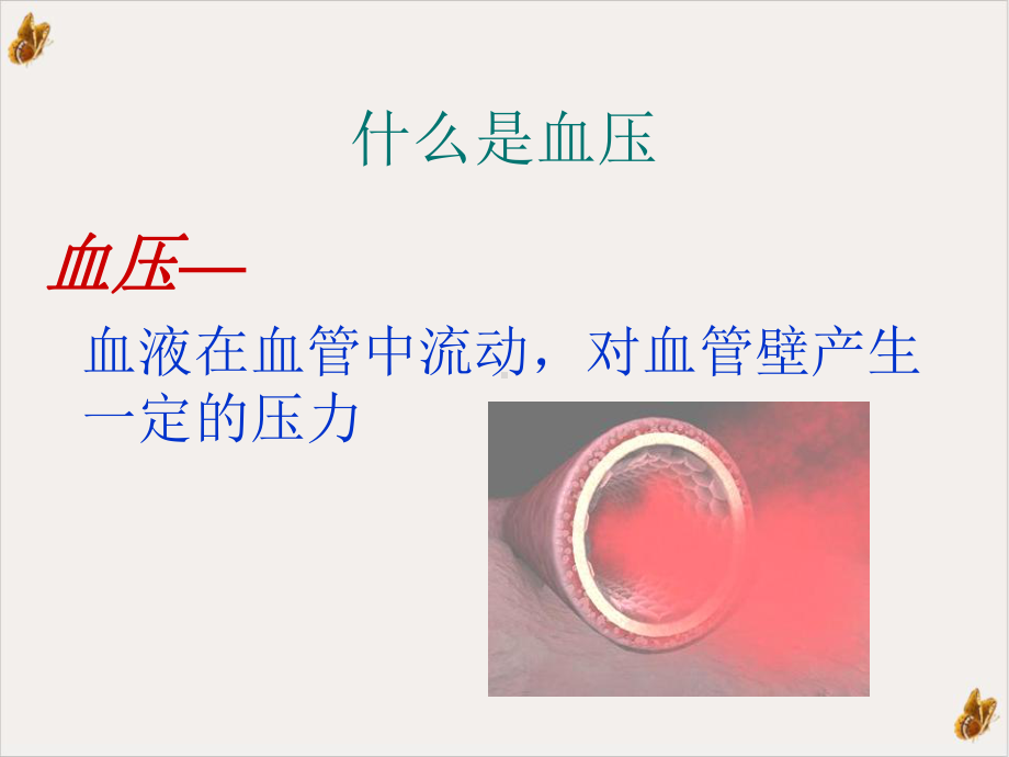 高血压健康知识宣教教学课件.ppt_第3页