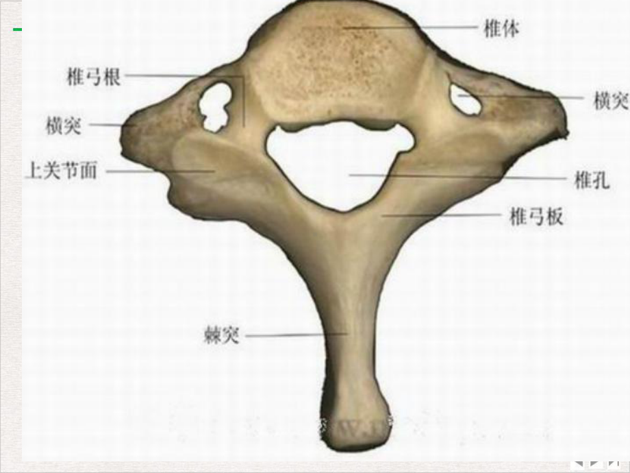 颈椎病的中医康复治疗完整版课件.ppt_第3页