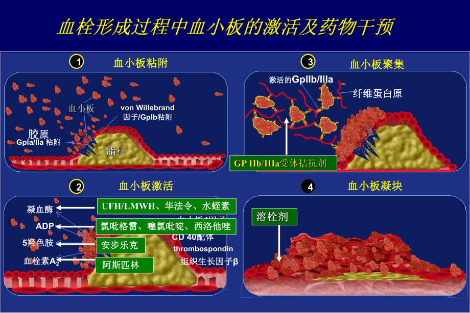 最新GP-IIb-IIIa-受体拮抗剂研究新进展09[1]1110课件.ppt_第2页