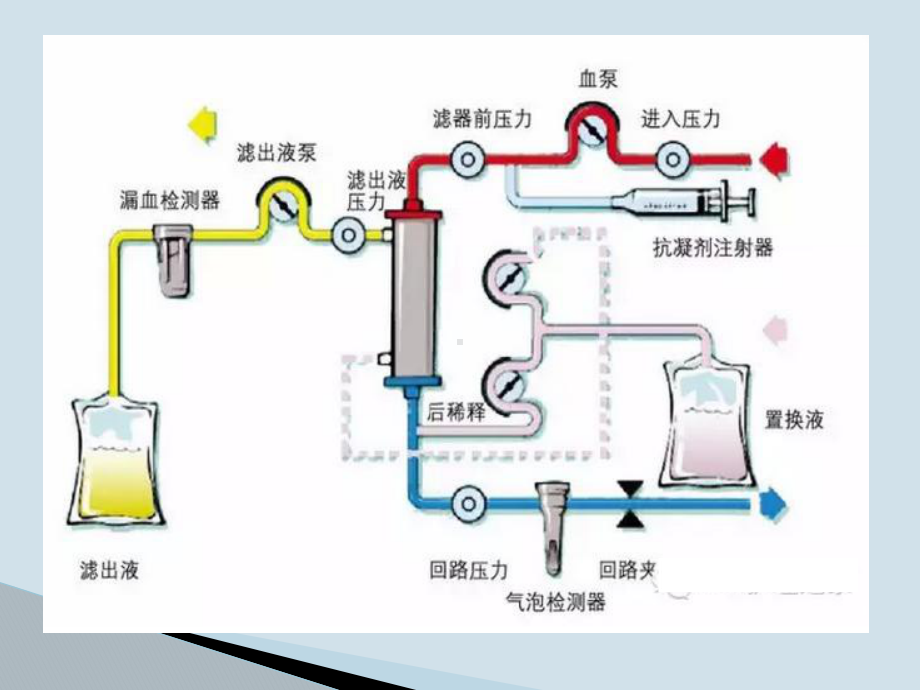 血液透析护理操作过程风险管理课件.pptx_第2页