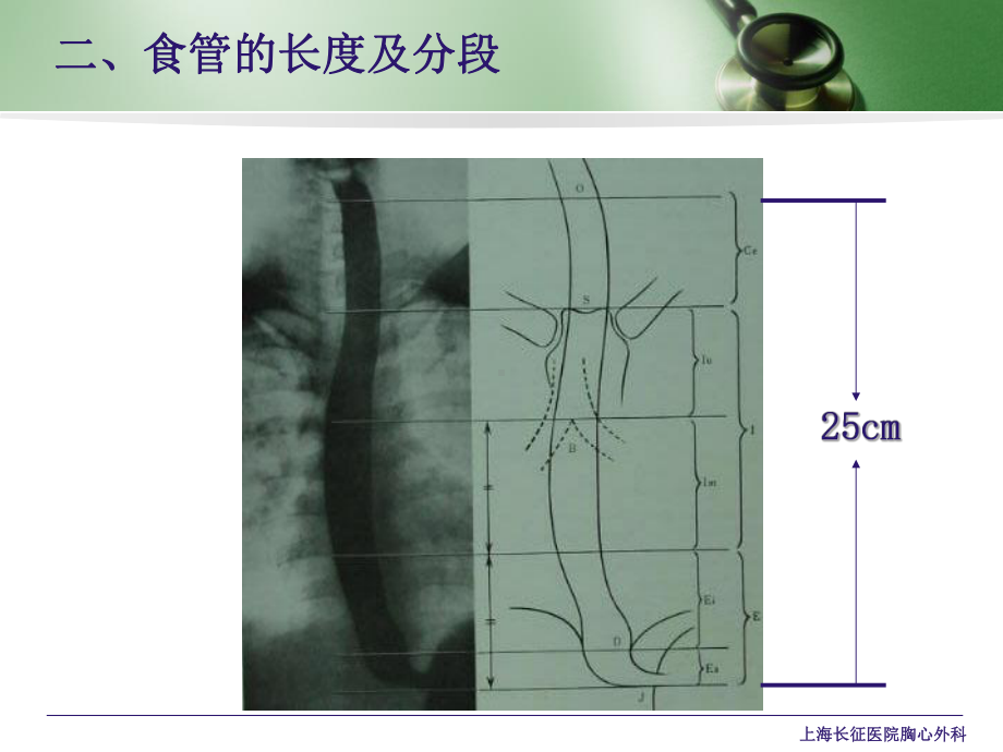 食管的常见疾病及其护理课件.ppt_第3页