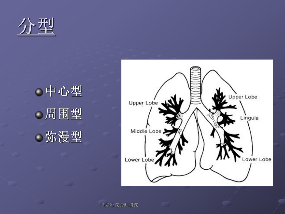 肺癌影像诊断讲课课件.ppt_第2页