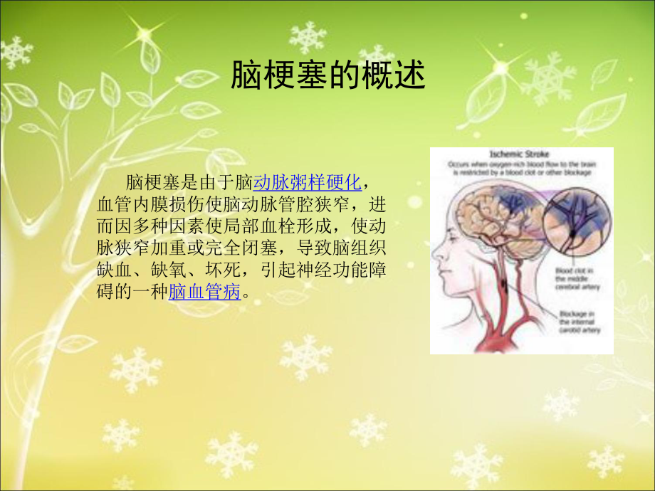 脑梗塞病人护理查房课件1.ppt_第2页