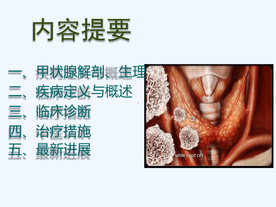 要讲桥本甲状腺炎课件.ppt_第2页