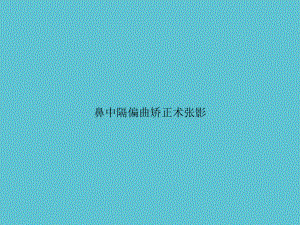 鼻中隔偏曲矫正术张影资料课件.ppt