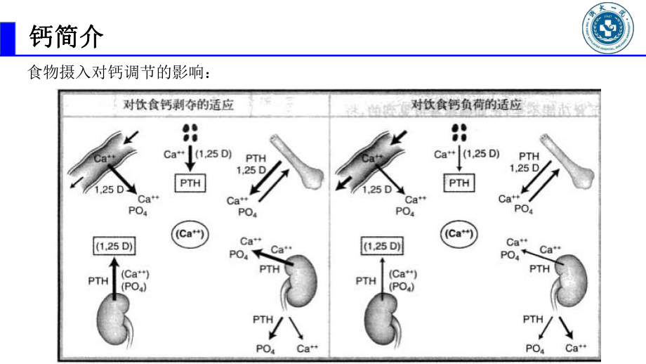 高钙血症--最新完整版本课件.ppt_第3页