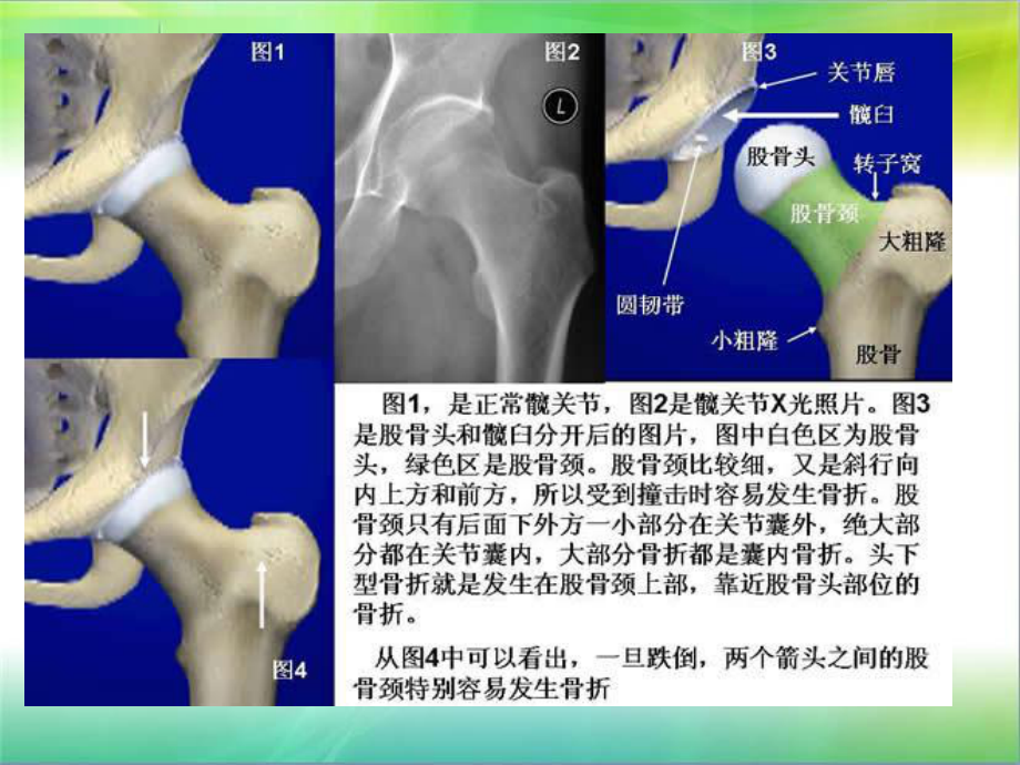 骨科业务学习演示文稿课件.ppt_第3页