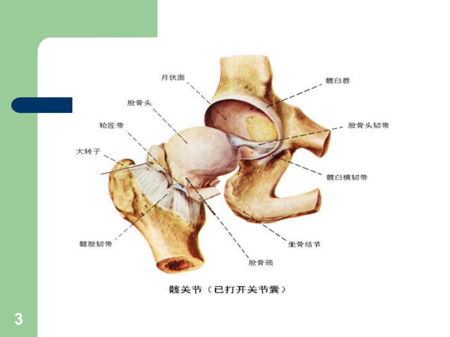 髋关节置换术后的的护理课件.ppt_第3页