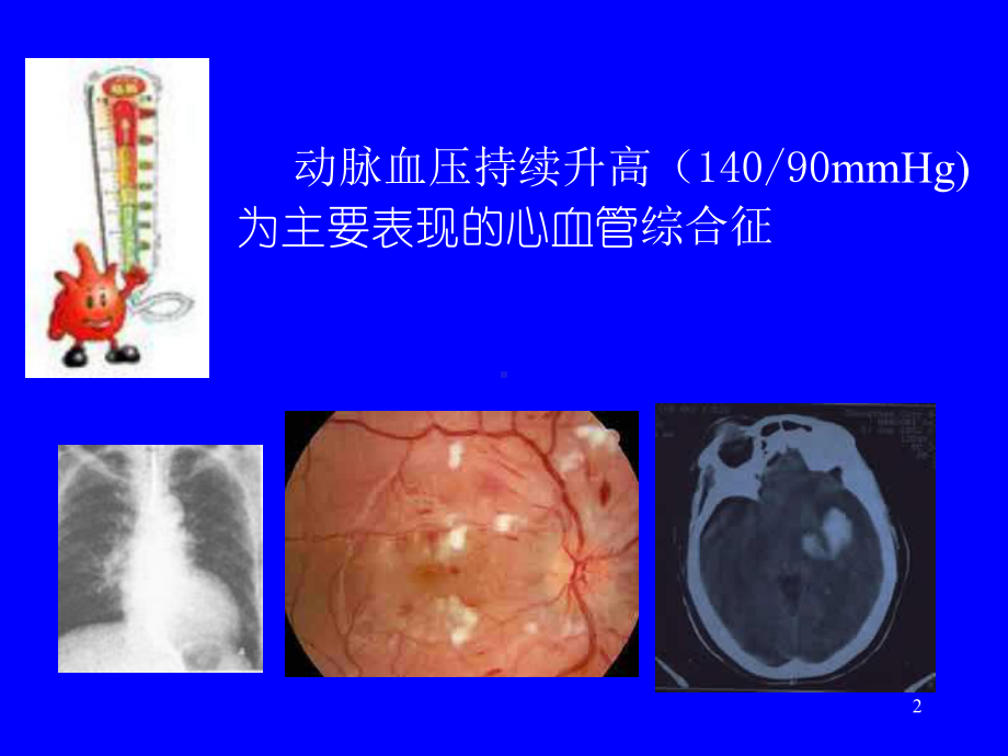 血管紧张素Ⅱ-长治医学院课件.ppt_第2页