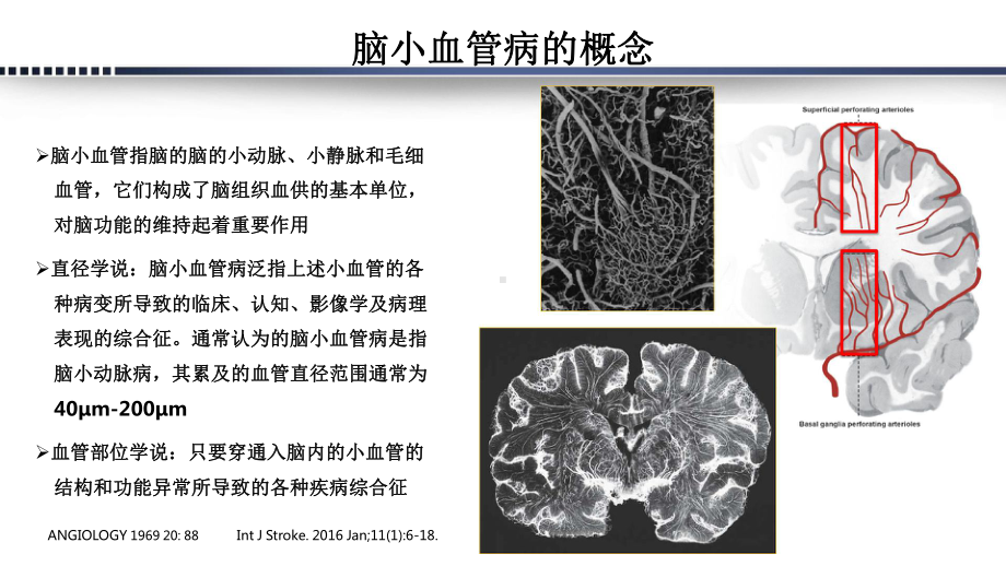 探索脑小血管病病理生理分类课件.pptx_第3页