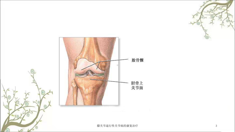 膝关节退行性关节病的康复治疗课件.ppt_第3页