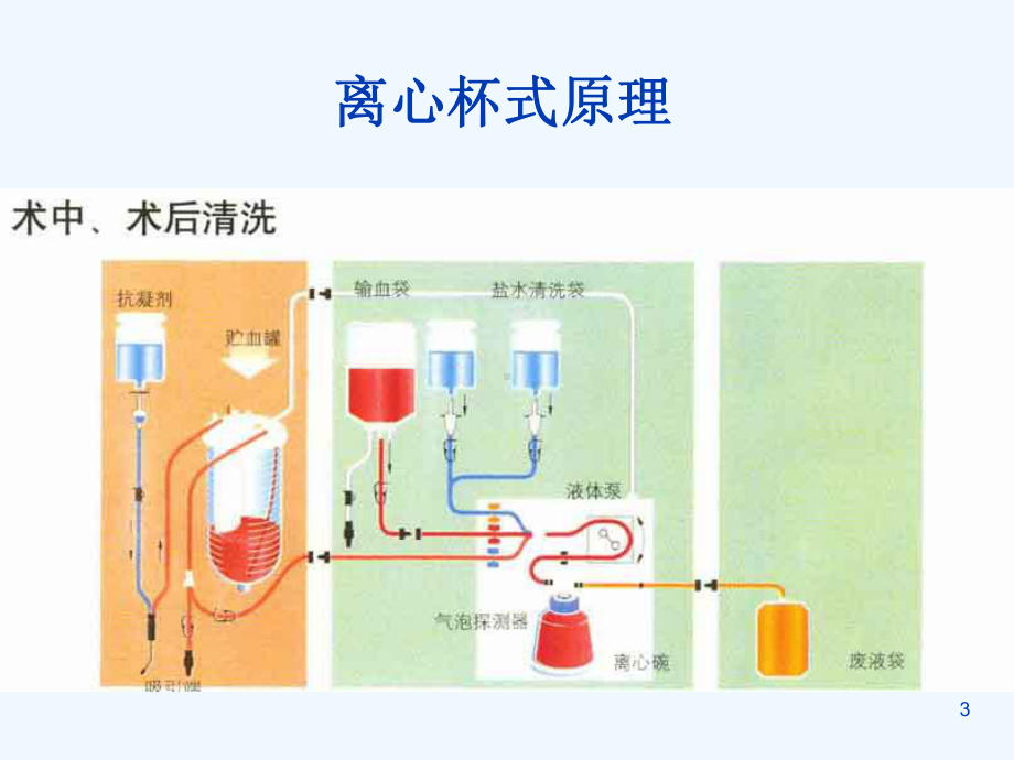 血液回收禁忌及适应症课件.ppt_第3页