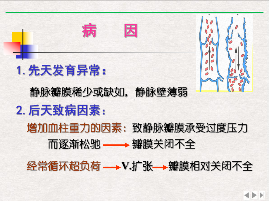 静脉曲张的相关知识和预防措施完美版课件.pptx_第3页