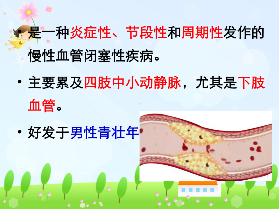 血栓性脉管炎课件.ppt_第2页