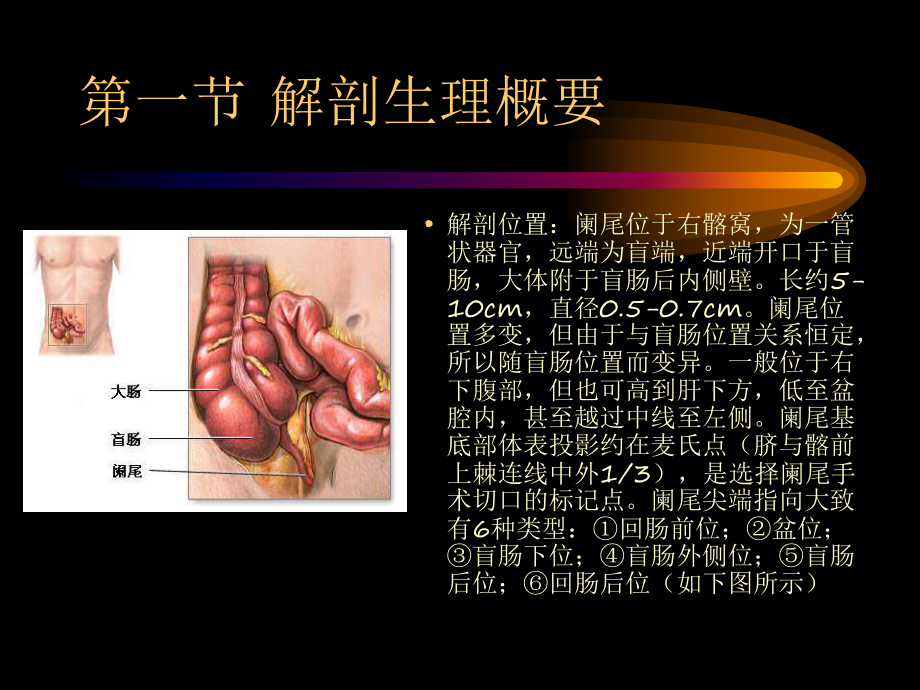 第三十九章阑尾炎课件.ppt_第3页