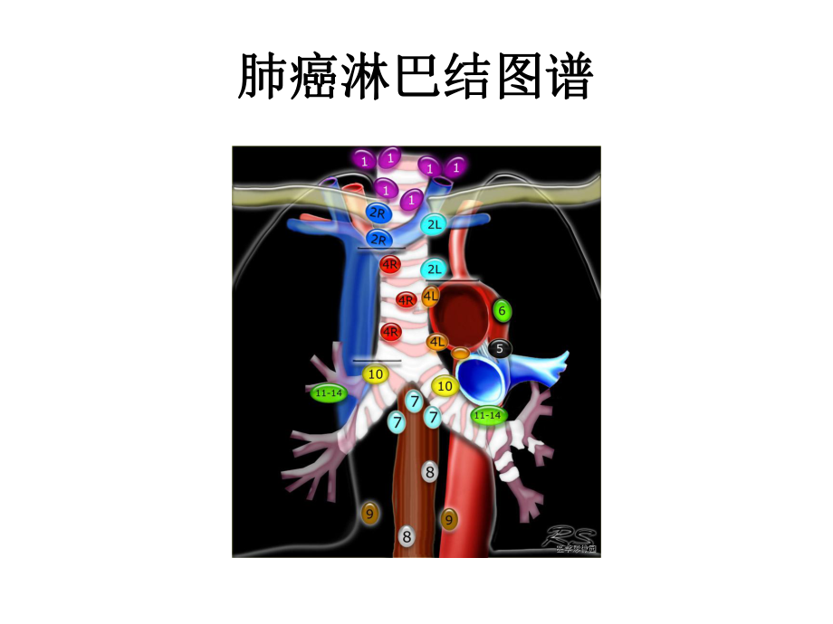 胸内淋巴结图谱课件.ppt_第3页