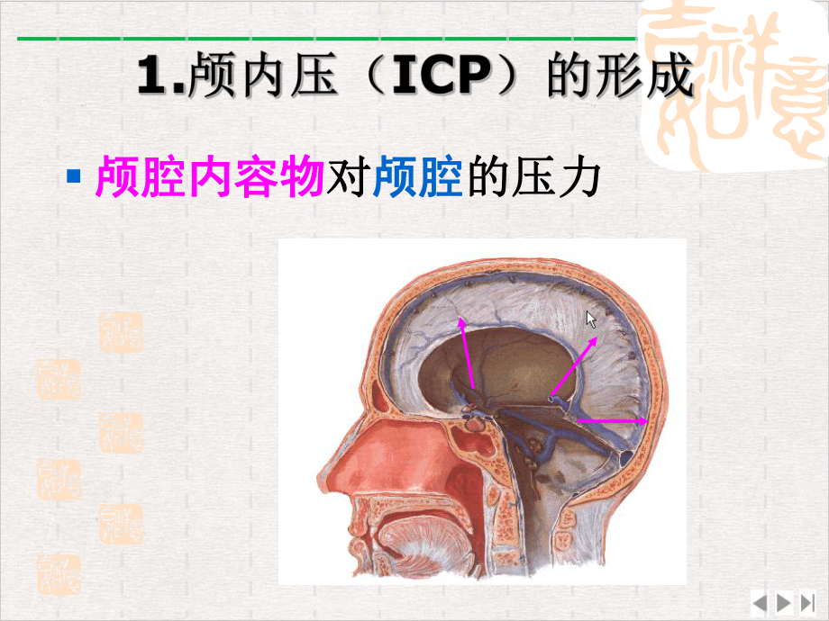 颅脑疾病病人的护理新版课件.pptx_第2页