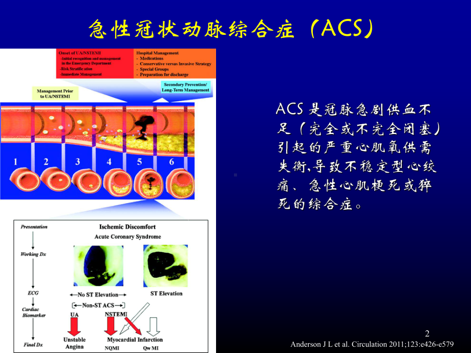 非st段抬高acs危险评估及治疗策略-课件.ppt_第2页