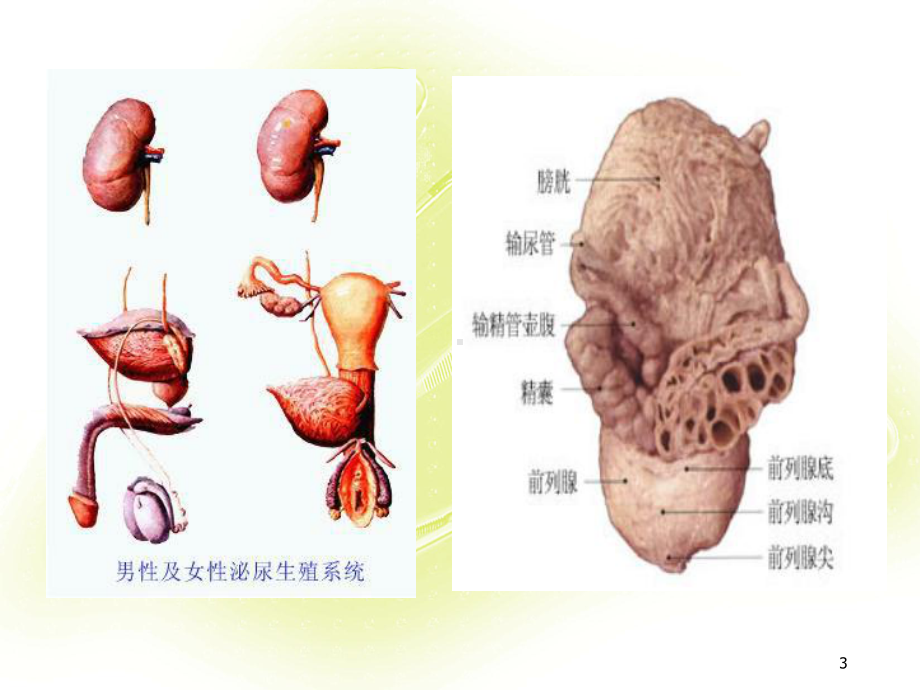 医学课件-泌尿外科微创手术的配合教学课件.ppt_第3页