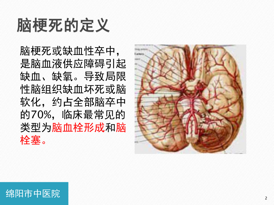 脑梗死患者的心理护理参考课件.ppt_第2页