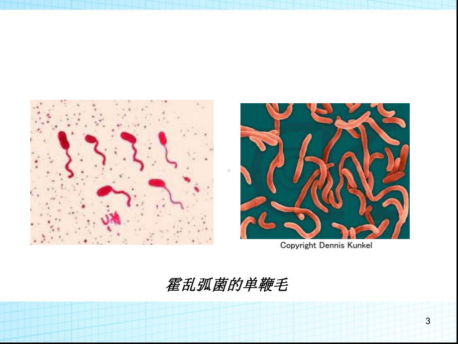 霍乱的护理课件.ppt_第3页