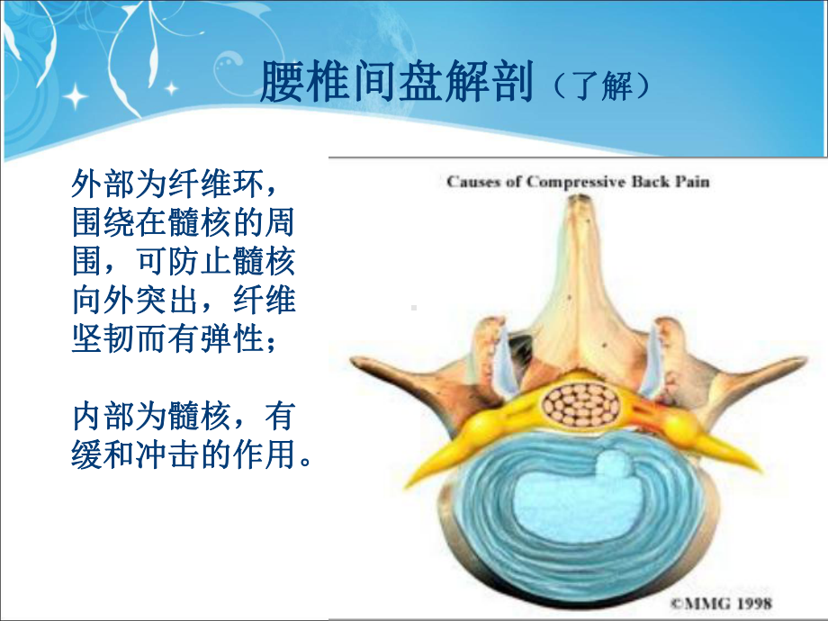 腰椎间盘突出症术后护理教学内容课件.ppt_第3页