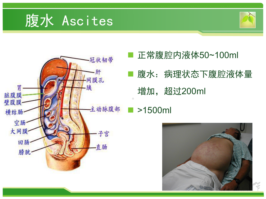 腹部病症分析教学课件.ppt_第3页