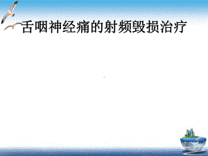 舌咽神经痛的射频毁损治疗课件.pptx