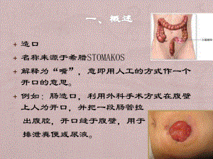 造口并发症的处理课件.ppt