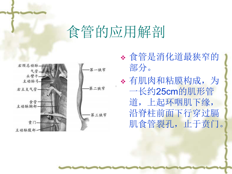 食管异物的护理课件.ppt_第3页