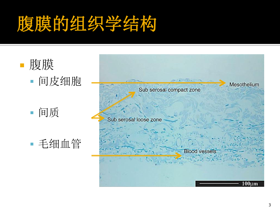 腹膜转运功能与临床应用课件讲义02.ppt_第3页