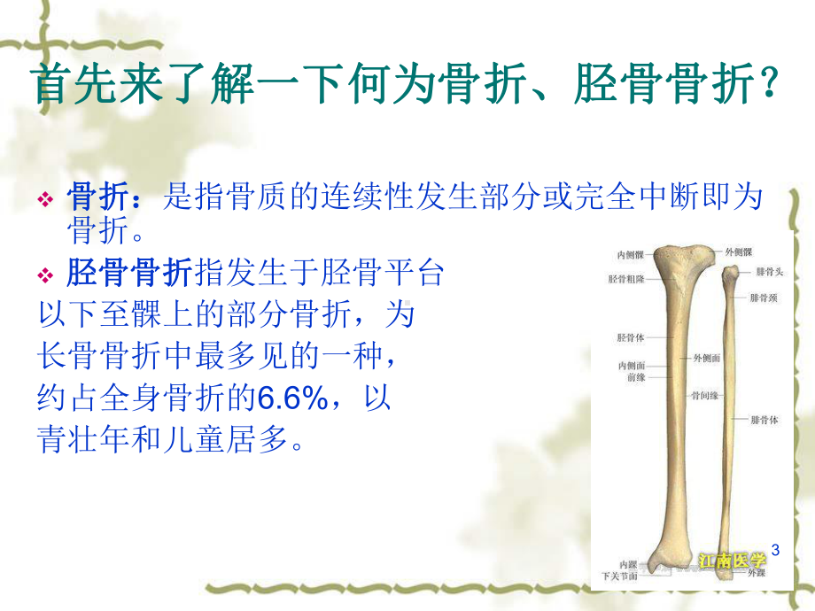 胫骨骨折的护理查房-演示文稿医学课件.ppt_第3页